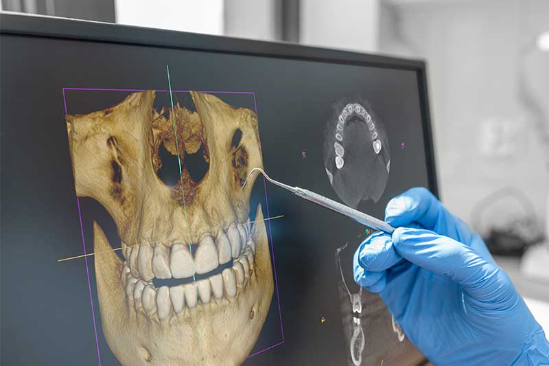 3D CBCT Imaging